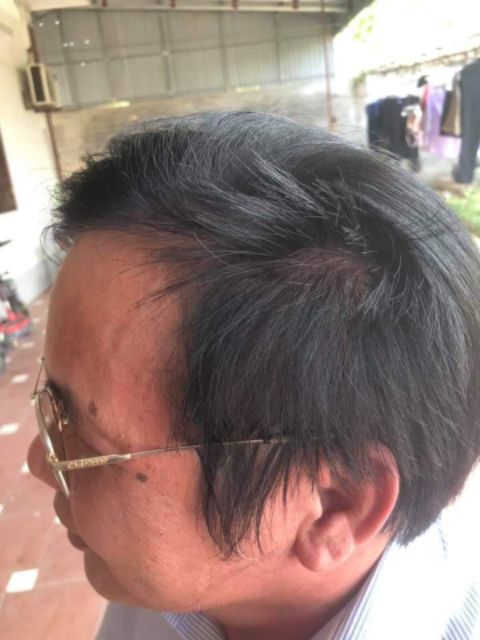 Bán sỉ 10 gói Gội đen nhân sâm thảo dược / gội là đen