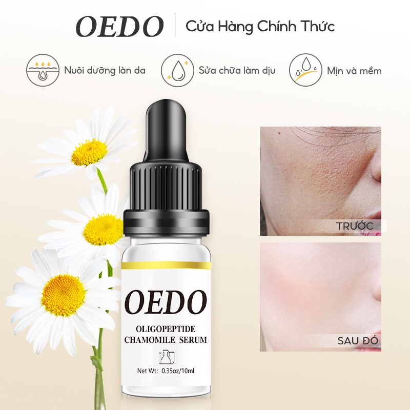 Oligopeptide Chamomile Serum OEDO Làm dịu và Phục hồi Chống nhăn Dưỡng ẩm Chăm sóc Chuyên sâu Cho Mặt 10ml