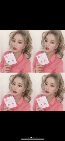 🎀🎀Miếng dán “thần kỳ” tạo mặt Vline Hàn Quốc