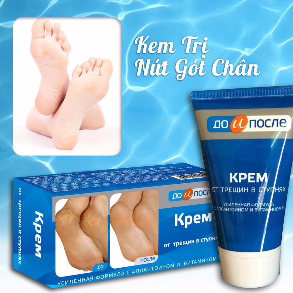 KEM DƯỠNG TRỊ NỨT GÓT CHÂN KPEM