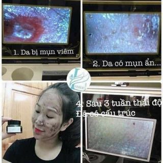 MẶT NẠ THẢI ĐỘC DETOX MASK DR.LACIR