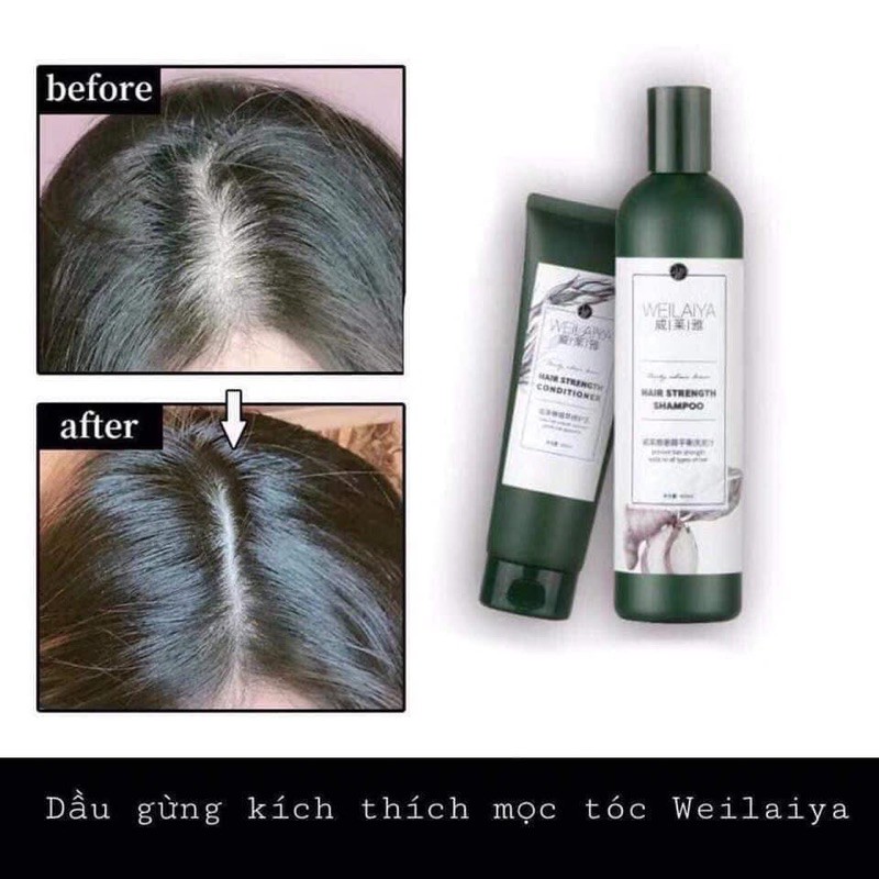 Bộ gội xả gừng weilaya 400ml trắng & thuốc bắc (tặng kèm sét mini) | BigBuy360 - bigbuy360.vn