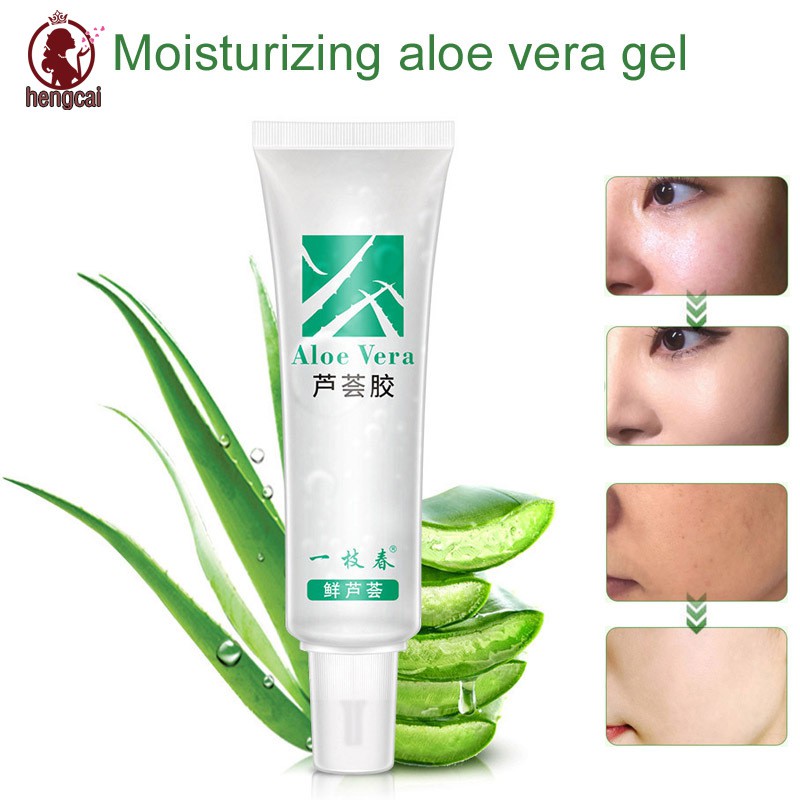 [Hàng mới về] Gel lô hội dưỡng da trị mụn cấp ẩm kiềm dầu hiệu quả