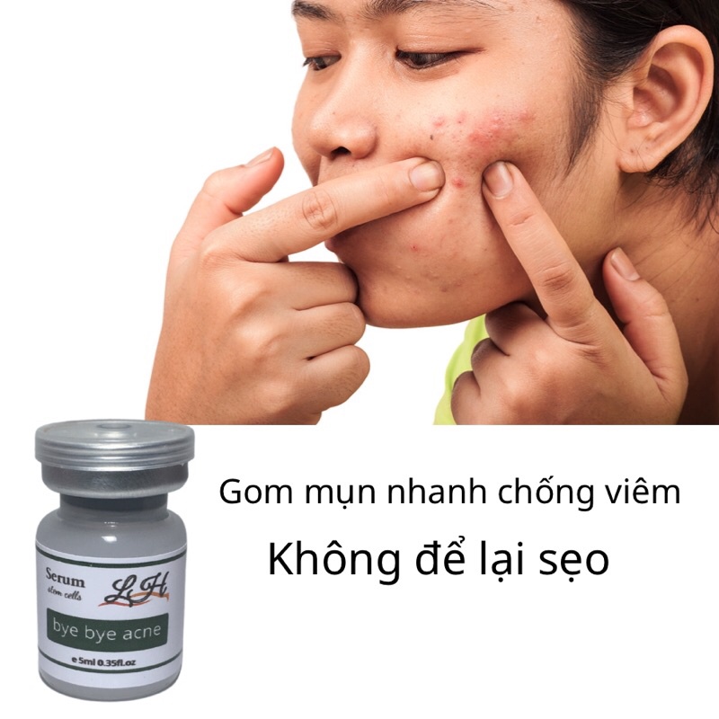 Serum giảm mụn thâm rỗ L&H  - Skin 7 Days - Công dụng 5 trong 1 hiệu quả sau 7 ngày, tạm biệt mụn