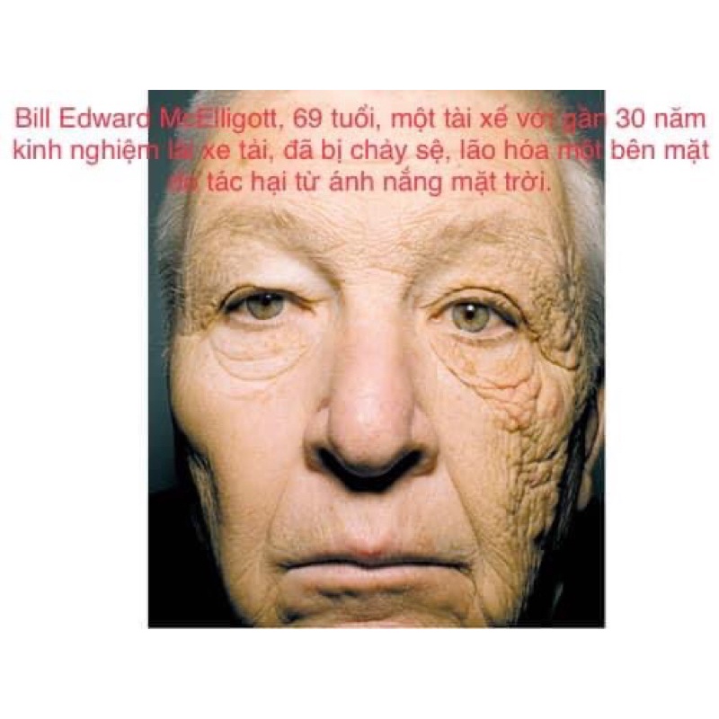 kem chống nắng Aelys lab