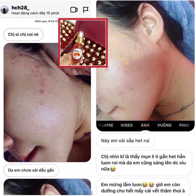 Tinh Dầu Gấc Tái Tạo Da | BigBuy360 - bigbuy360.vn