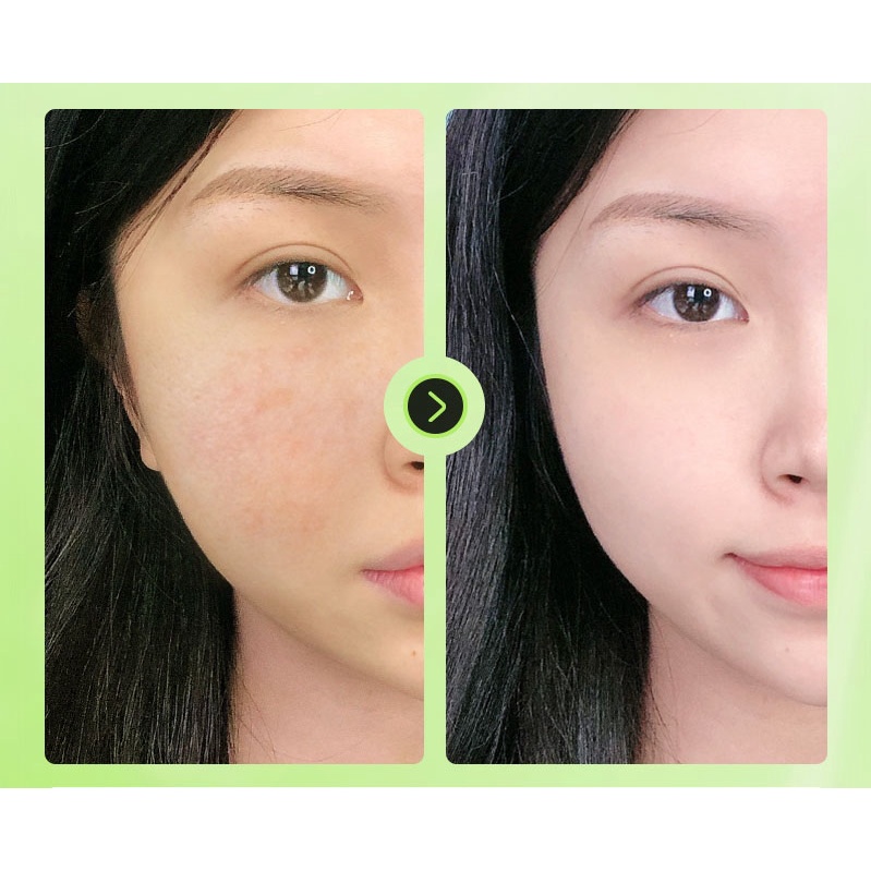 Toner nấm Origins Mega-Mushroom Skin Relief Smoothing Treatment Lotion 200ml