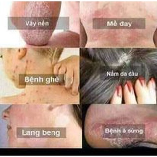 Kem boi da 999 nội địa