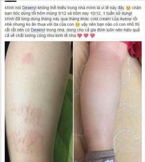 Kem nẻ Pháp Dexeryl - Tuýp 250Gr