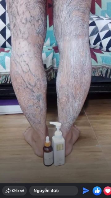 [giá sập sàn]Kem tẩy lông huyền phi tặng kèm serum triệt lông vĩnh viễn | BigBuy360 - bigbuy360.vn