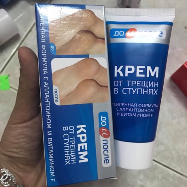 Kem Trị Nứt Gót Chân Kpem