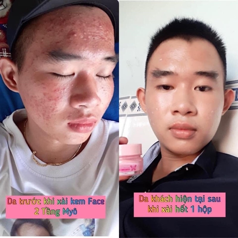 [Chính Hãng] Kem Face 2 Tầng Myô