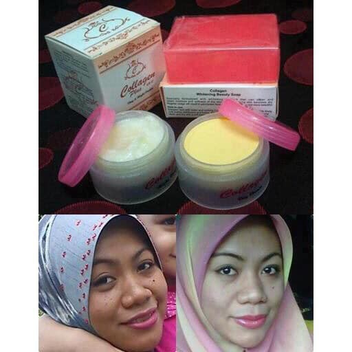 Cam Kết Hàng Chuẩn Kem Ngày Và Đêm Face Collagen Plus Vit E