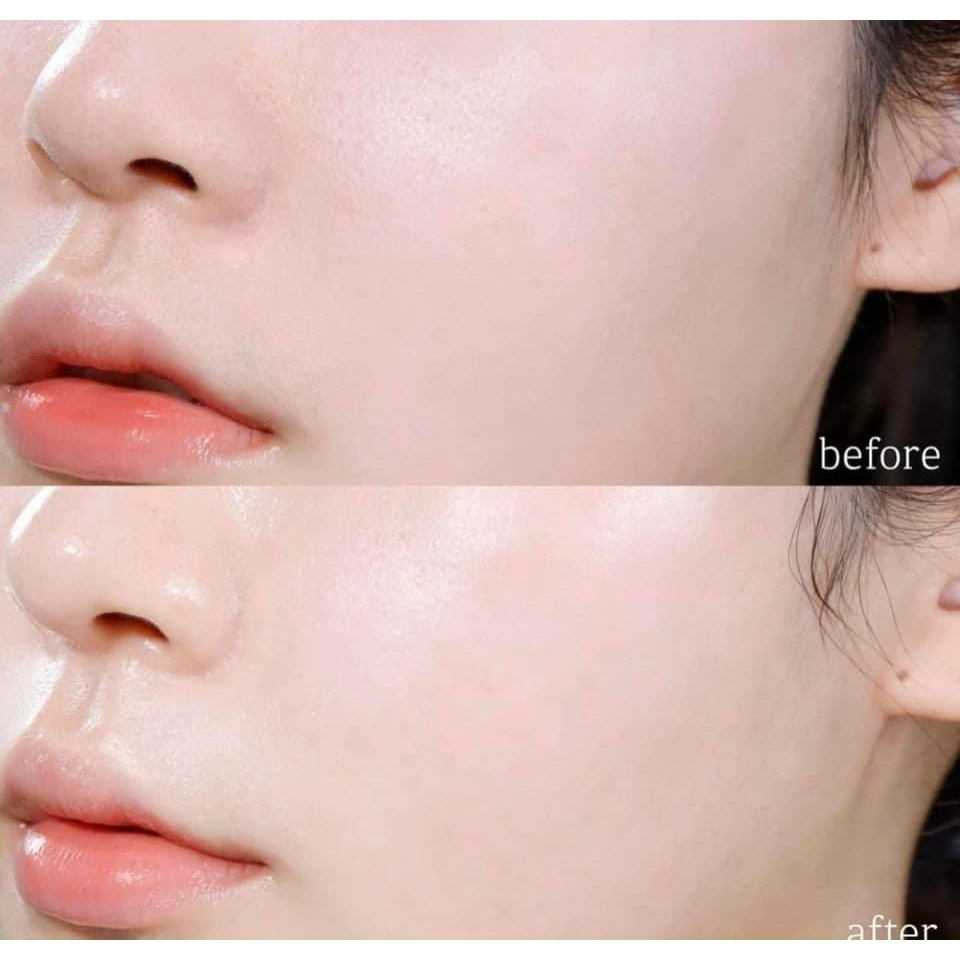 Mặt nạ thạch vàng Filler collagen 83% medianswer vita collagen mask	.