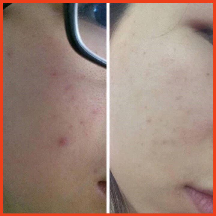 Sữa Rửa Mặt Cho Da Nhạy Cảm The Beauty Of Jones 100ml Và 20ml