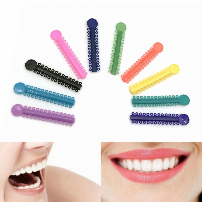 Set 10 que buộc dây chun chỉnh nha với móc tròn chuyên dụng