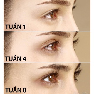 DƯỠNG DÀI MI CAREPROST BIMATOPROST OPHTHALMIC SOLUTION 5ML