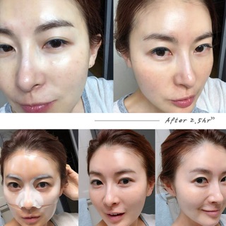 MẶT NẠ CAO CẤP DERM ALL MATRIX MẪU MỚI