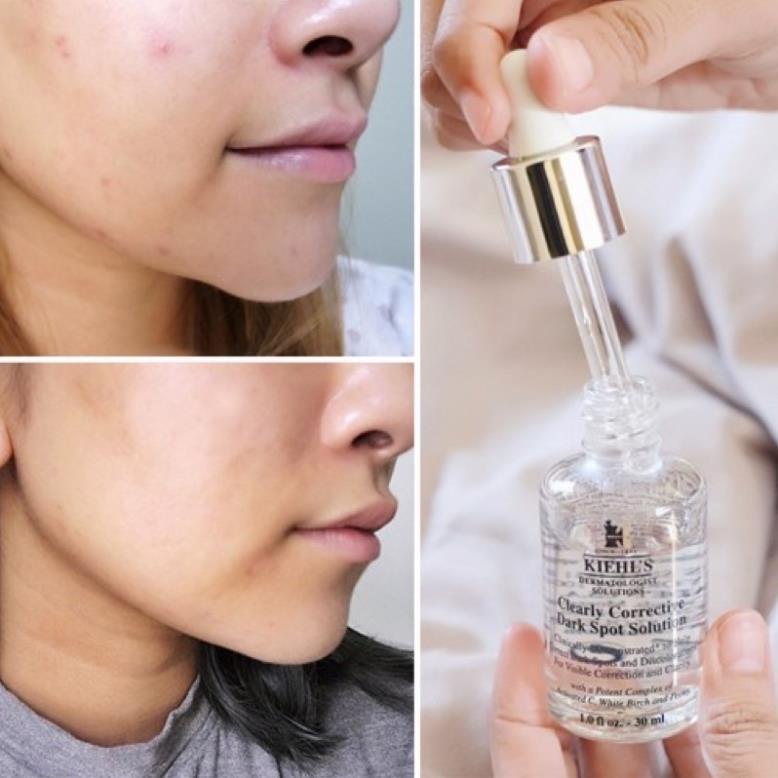 Serum Mờ Thâm Mụn & Đồng Đều Màu Da Kiehl's Clearly Corrective Dark Spot Solution 10ml