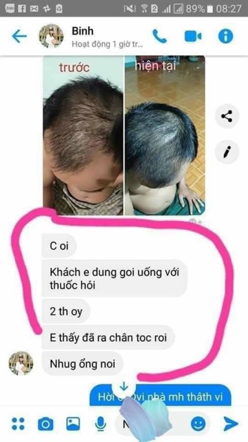 (Combo_tiết kiệm)3 chai Hà Thủ Ô phiên bản đặc biệt nuôi dưỡng phục hồi và mọc tóc