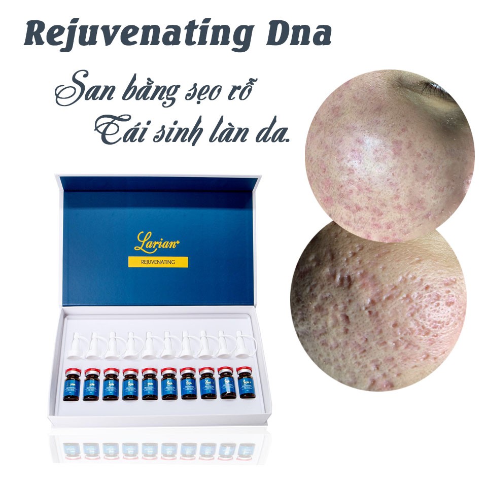 Tế bào gốc tái tạo da Rejuvenating Serum DNA  Cá Hồi. làm đầy sẹo rỗ, thu nhỏ lỗ chân lông, trẻ hoá da.(lọ 8ml)