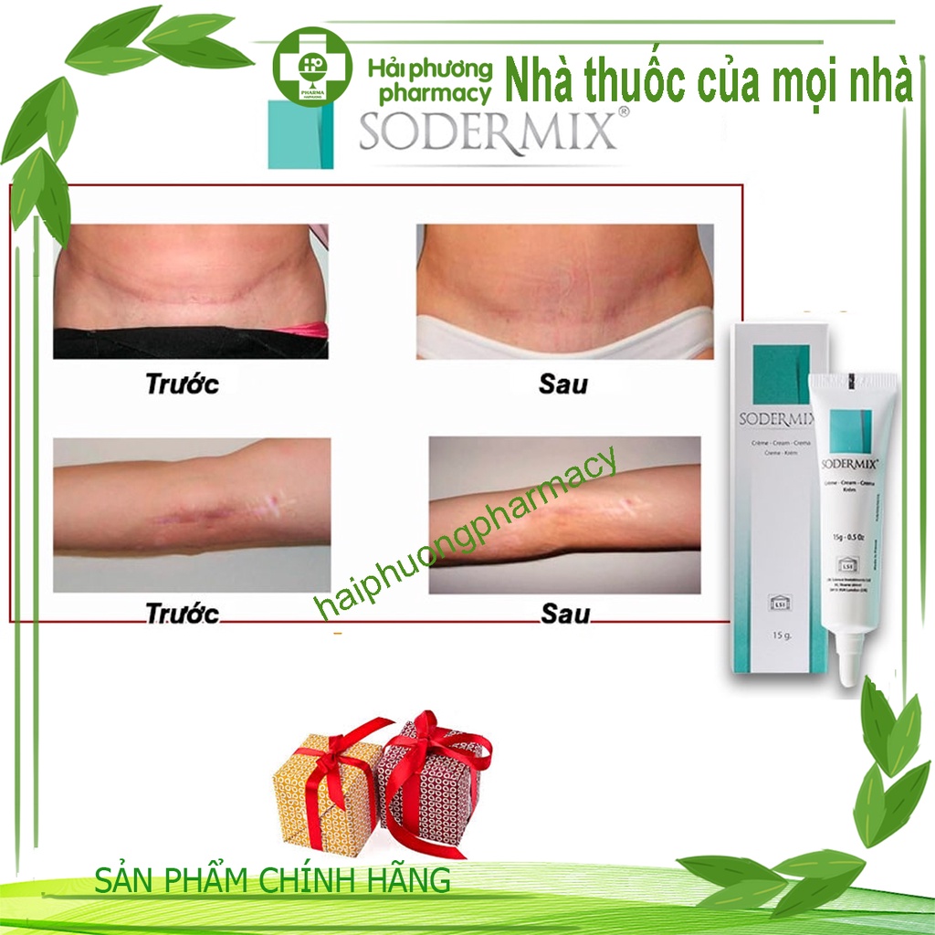 Sodermix Cream 15g - Dùng cho sẹo lồi, sẹo phì đại, chàm Sodemix