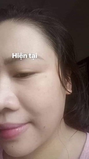 500g Bột đậu đỏ đắp mặt và tắm trắng