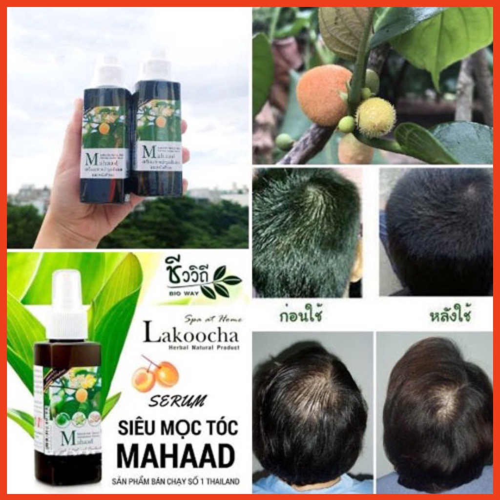 Xịt Kích Mọc Tóc Mahaad Thái 120ml