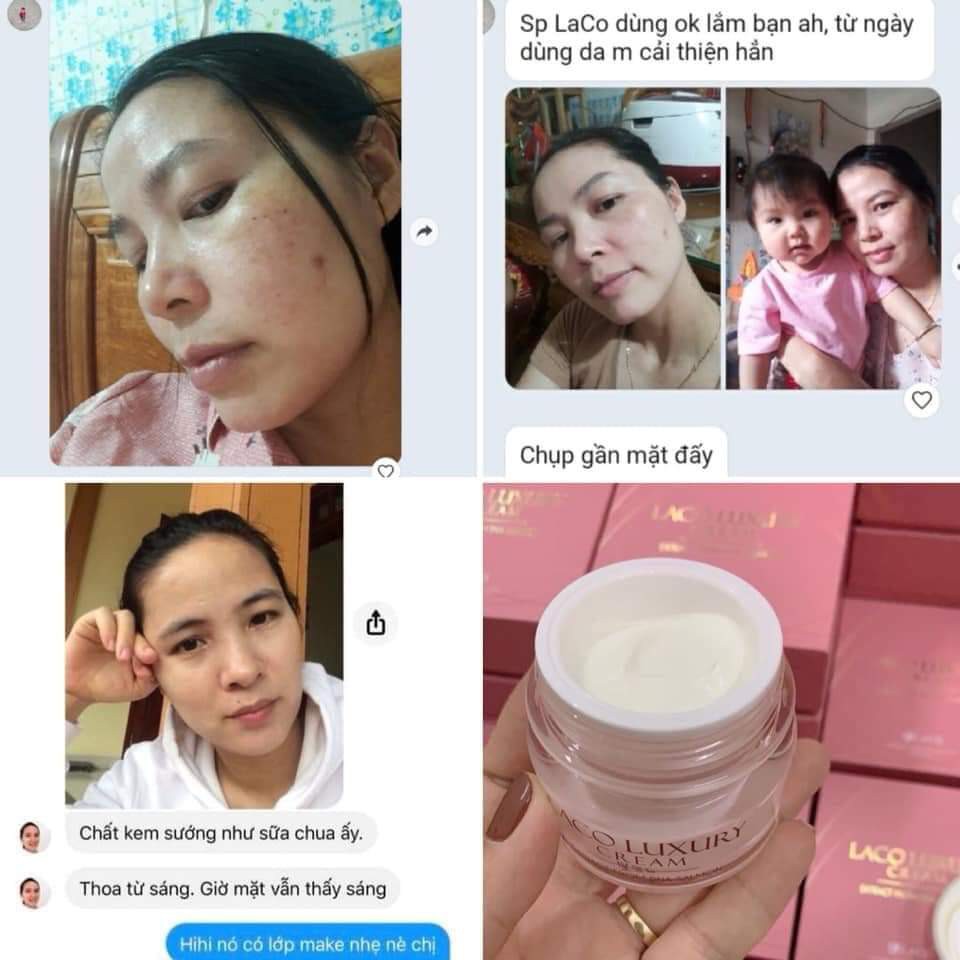Kem Ngày Laco Dưỡng Da , Chống Nắng, MAKEUP 3 IN 1 | BigBuy360 - bigbuy360.vn
