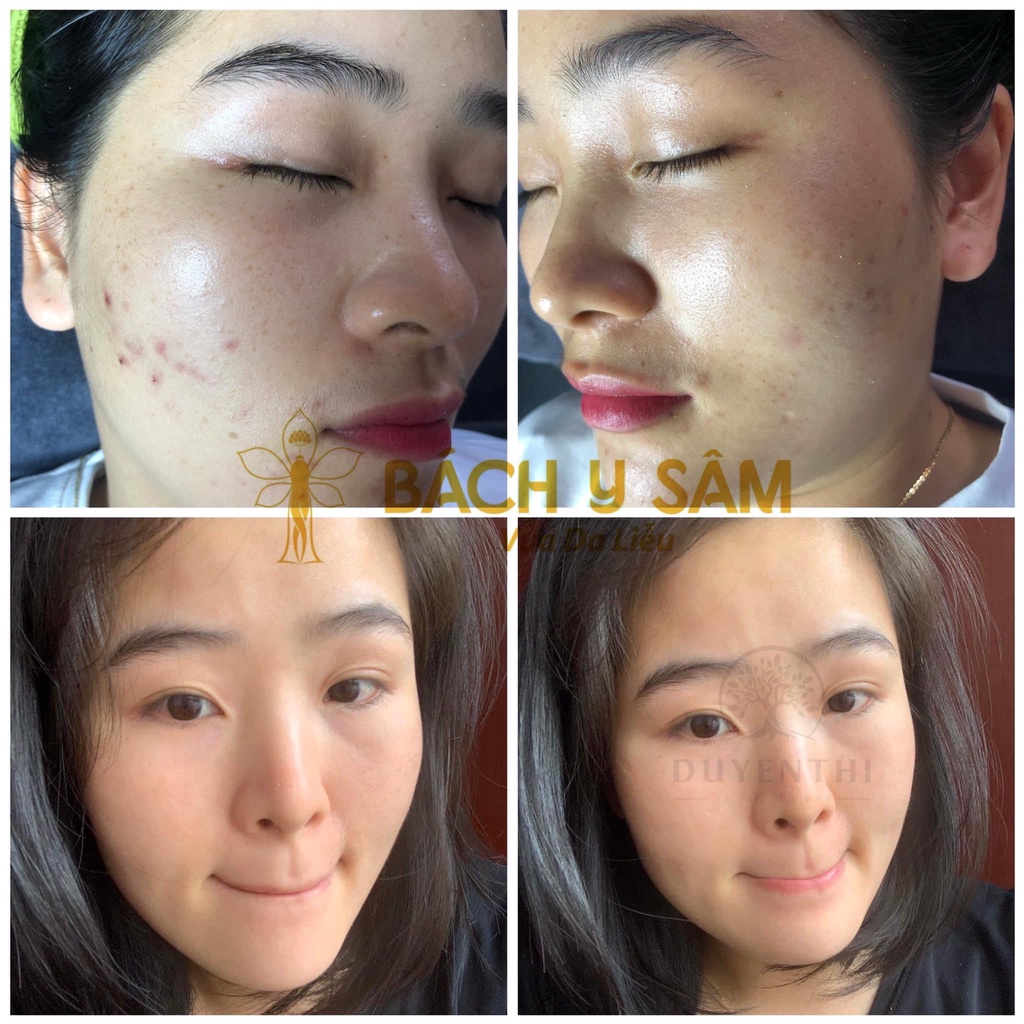 D23 Bách Y Sâm TÁI TẠO NUÔI DA TỪ GỐC ĐỈNH CAO 15ml
