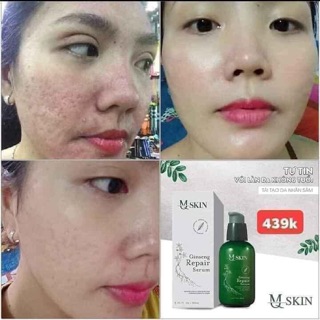 Serum mskin nhân sâm