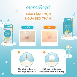 Combo 3 hộp miếng dán mụn Derma Angel (2 x 12 miếng và 18 miếng)
