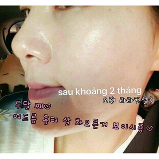 Combo 50 gói Tinh Chất Vàng OHUI The First