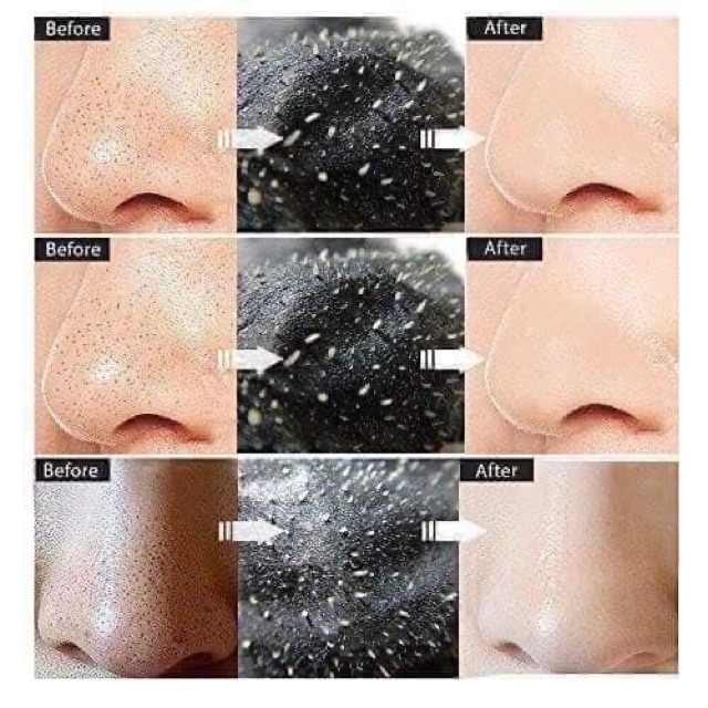 GEL LỘT MỤN BLACKHEAD MISTINE