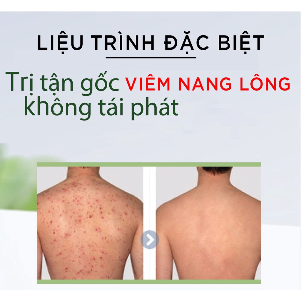 Xịt mụn lưng, mụn body - Thảo mộc giúp sạch mụn, hết thâm, làm mềm và sáng da body MEE NATURAL 50ml