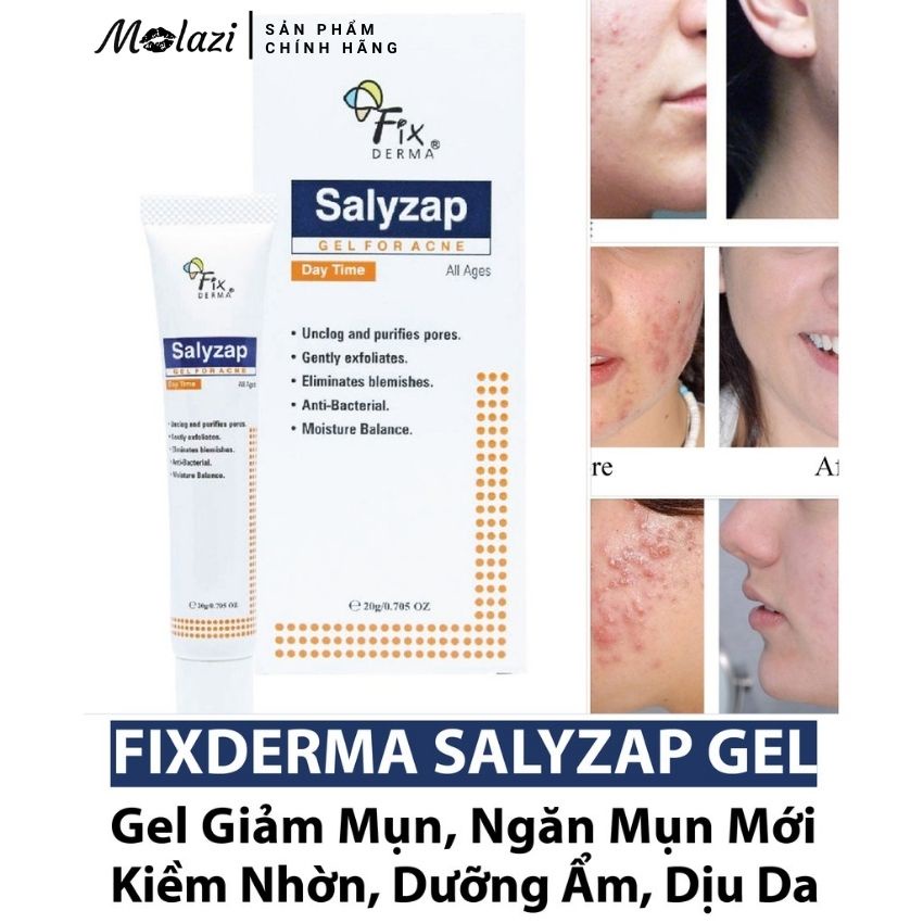 Kem chấm mụn Fixderma Salyzap giảm ngừa mụn dưỡng ẩm tái tạo dưỡng trắng phục hồi da mờ thâm (gel chấm mụn 20gr) molazi. | BigBuy360 - bigbuy360.vn