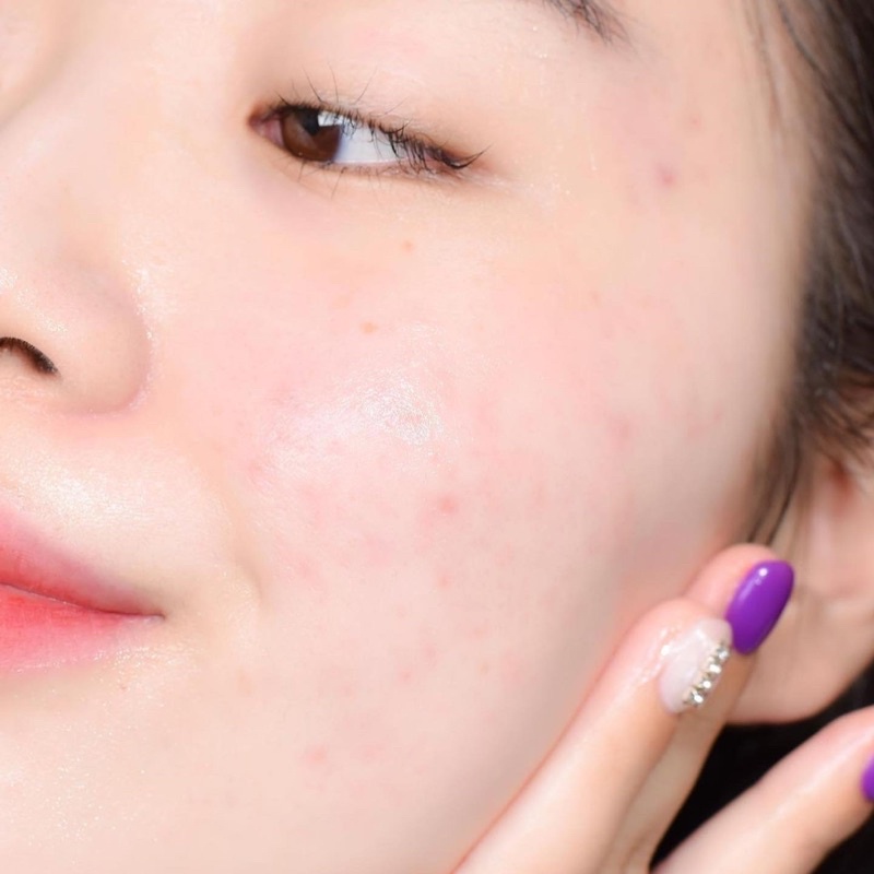 Kem dưỡng Illiyoon Hyaluronic Moisture Cream