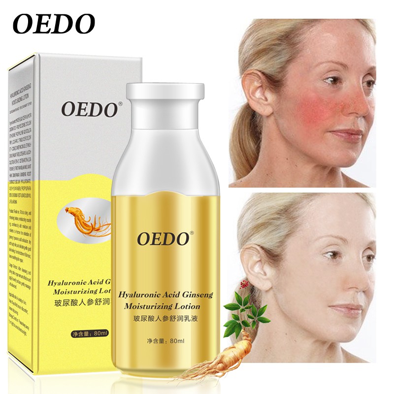 Set 3 mỹ phẩm chăm sóc da Oedo dưỡng ẩm và chống mụn cao cấp