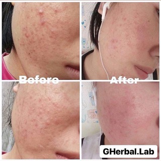 [SALE] bột diếp cá gói lớn
