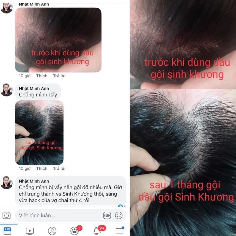 Bộ Gội ủ gừng Sinh Khương Sam Natural Phục Hồi Tóc Hư Tổn 500ML