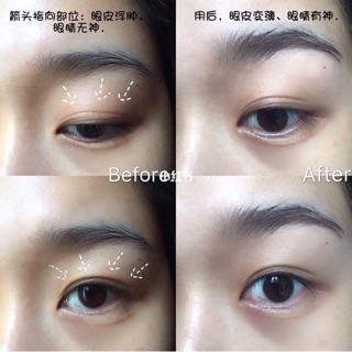 Serum dưỡng MẮT