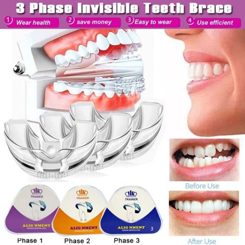 Đai Đeo Nẹp Cố Định Làm Đẹp Chống Ngã ​Set 3 Dụng Cụ Niềng Răng Vô Hình Chuyên Nghiệp