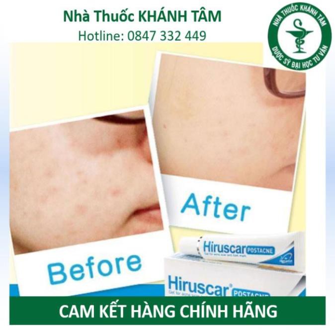 ! Gel làm mờ sẹo mụn và thâm mụn Hiruscar Post Acne [Hirusca, post acnes] ! !