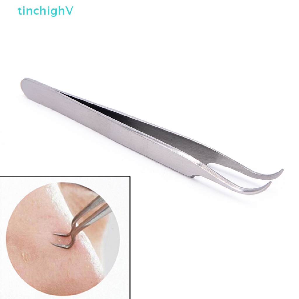 [TinchighV] Kẹp Loại Bỏ Mụn Đầu Đen Dạng Cong Làm Sạch Da Mặt