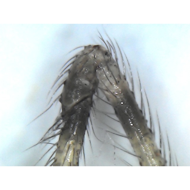 Máy soi da soi tóc mini spa thẫm mỹ viện phóng đại 1600X kết nối điện thoại và máy tính Digital Microscope