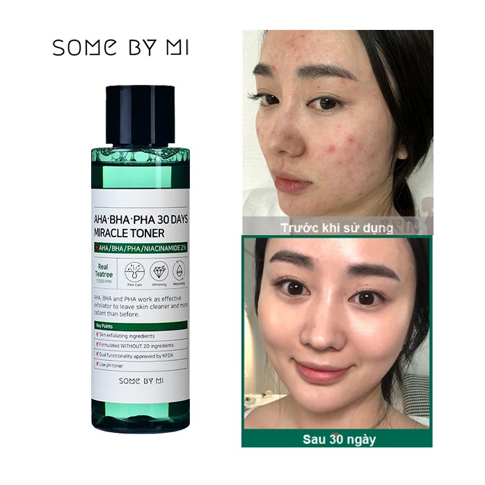 [CHÍNH HÃNG] Nước Hoa Hồng Ngừa Mụn Some By Mi AHA-BHA-PHA 30 Days Miracle Toner 150ml