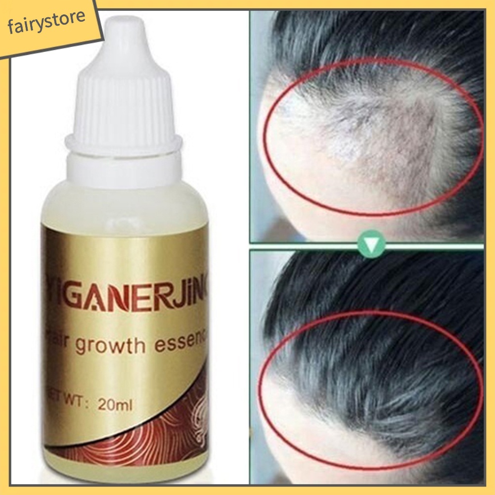 Tinh chất thúc đẩy mọc tóc 20ml cao cấp