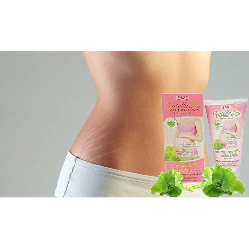 KEM TRỊ RẠN DA ISME CENTELLA STRETCH MARK CHÍNH HÃNG - 3934