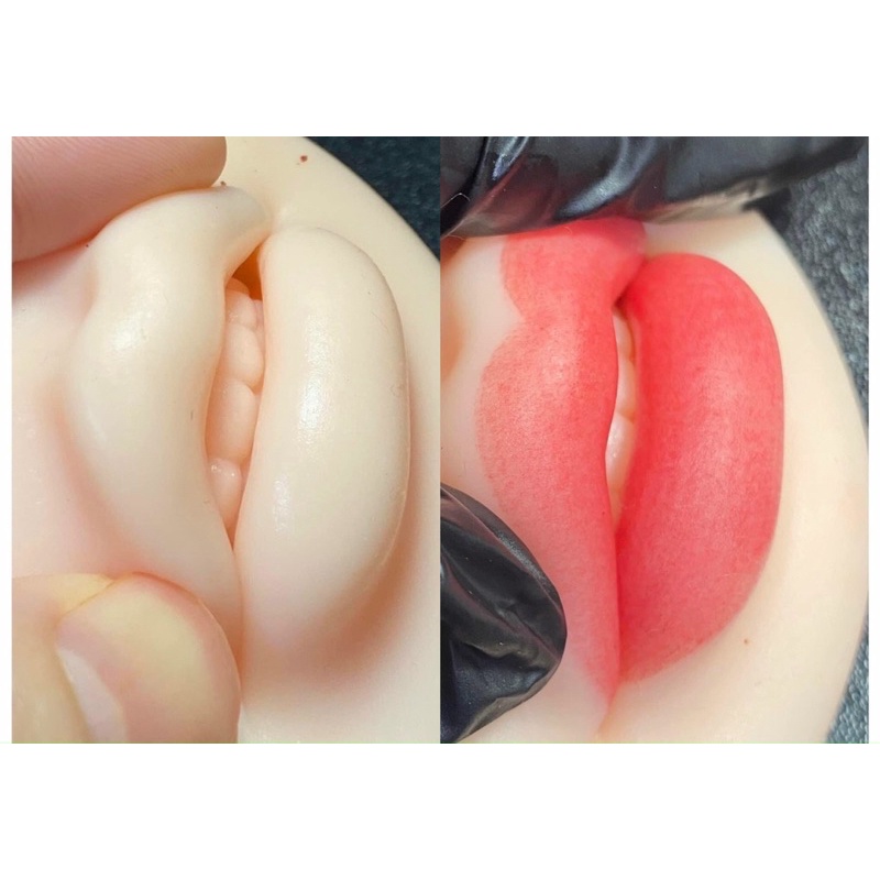 Môi giả 5D tập phun môi, tiêm filler