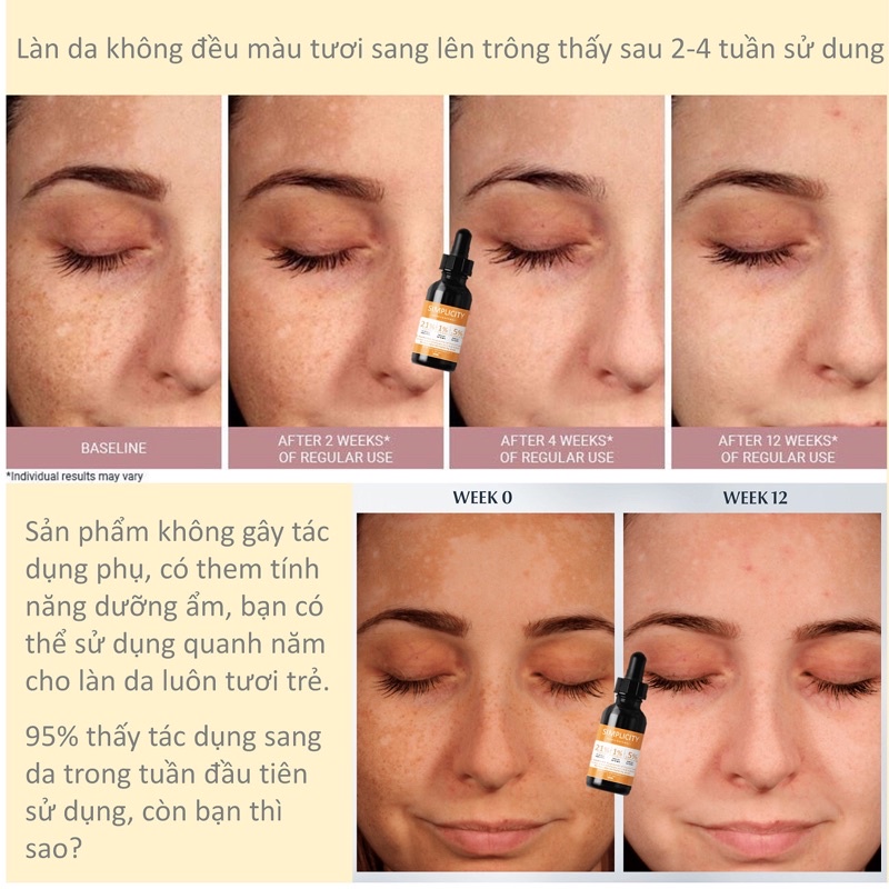 Tinh chất trắng da mờ thâm 20% Vitamin C 0.5% Ferulic acid 1% Vitamin E Simplicity